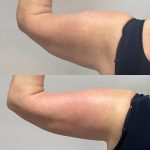 8D83201F-1BDC-4536-AD54-5D20F032DB03